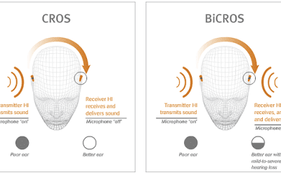 Unilateral Hearing Loss