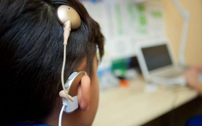 What Is the Difference Between a Cochlear Implant and Hearing Aid?